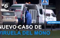 Albacete registra un nuevo contagio por viruela del mono